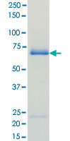 Loading 1 &mu;g protein in SDS-PAGE